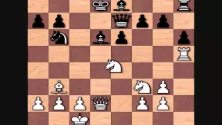 Garry Kasparov's Best Games: vs Anatoly Karpov