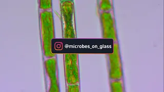 Нитчатая водоросль в аквариуме под микроскопом. Green Hair Algae