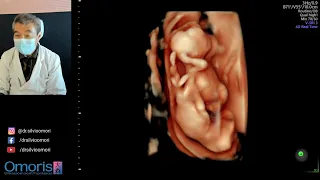 TWINS: EXCITEMENT OF DISCOVERY IN ULTRASOUND!!