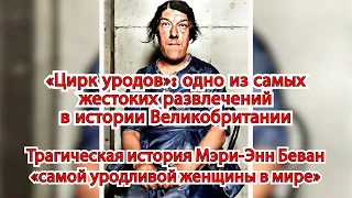 "Цирк уродов" жестокoe развлечениe в истории Великобритании. История “самой уродливой женщины мирa”