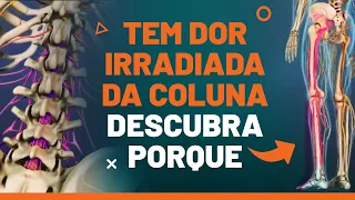 DOR IRRADIADA PARA PERNA, O QUE FAZER?- Fisioprev