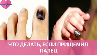 прищемил палец?  pinched your finger?