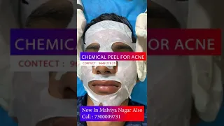 Best Chemical Peel Treatment for acne at Skinaa Clinic | Viral #shorts