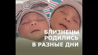 Близнецы родились в разные дни и в разные годы