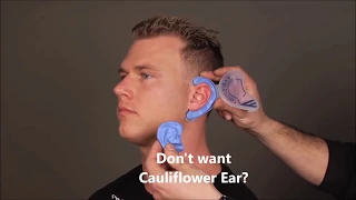 Don't want Cauliflower Ear? Cauliflower Ear Prevention in 5 minutes at home