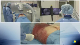 AO pelvic & Acetabulum Surgical exposure; Percutaneous iliosacral screw insertion, prone upper, 2nd