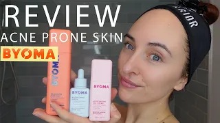 BYOMA SKINCARE REVIEW ✨ ACNE PRONE SKIN