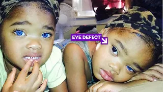 Do you remember the blue eyes twins? See how they look like today