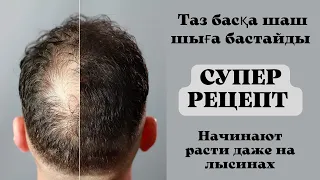 ШАШТЫҢ ТҮСУІ МЕН ТАЗ БОЛУЫН ТОҚТАТАДЫ. ЖАҢА ШАШТЫҢ ШЫҒУЫНА КӨМЕКТЕСЕДІ.