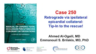 Case 250: Manual of CTO PCI - Retrograde via ipsilateral epicardial collateral: tip in to the rescue