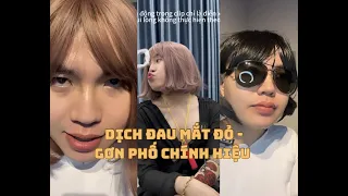 DỊCH ĐAU MẮT ĐỎ - KIỆT HÀ TỊNH HOÁ GƠN PHỐ ĐI HỌC KHÉT LẸT