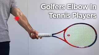 Golfers Elbow In Tennis Players | How To Treat & Rehab Medial Epicondylitis