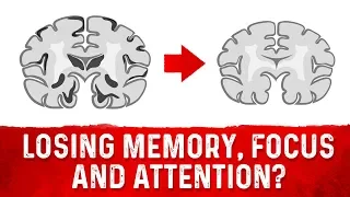 Is Your Brain Shrinking? – Dr.Berg On Brain Health & Brain Atrophy