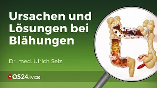 Die Hauptursachen für Blähungen | Dr. med. Ulrich Selz | Erfahrungsmedizin | QS24