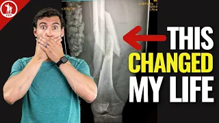 How To Deal With A Major Injury (Dr. A’s Life-Changing Story)