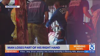 Man loses part of hand, house catches fire amid July 4 fireworks mishaps