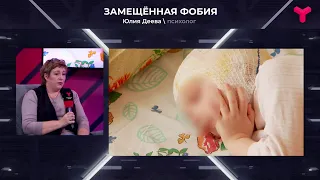 Последствия от укуса собаки