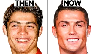 Cristiano Ronaldo NEW FACE | Plastic Surgery Analysis