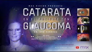 Catarata en el paciente con Glaucoma - Dra. Ana Sanseau