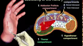 Compartment Syndrome Of The Hand & Finger - Everything You Need To Know - Dr. Nabil Ebraheim