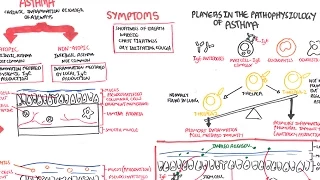 Asthma - signs and symptoms, pathophysiology