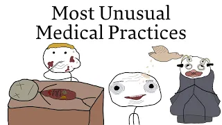 Most Unusual Medical Practices Through History