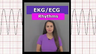 ECG EKG Heart Rhythms Nursing #shorts (afib, vtach, bradycardia, sinus rhythm, aflutter)