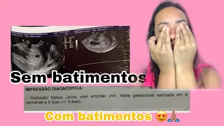 Do aborto Retido ao Milagre da Vida