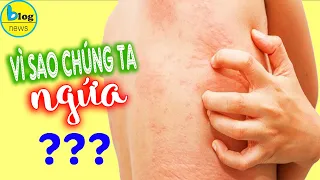 Những nguyên nhân phổ biến gây ngứa da toàn thân