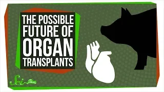 Bioprinting and Pig Chimeras: The Possible Future of Organ Transplants