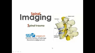 Imaging of Spinal trauma - Prof. Mamdouh Mahfouz