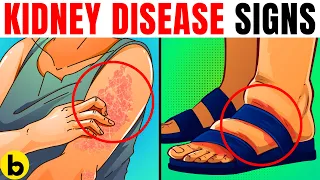 10 Kidney Disease WARNING Signs You Must NOT IGNORE!