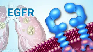 Understanding NSCLC Treatment When You Have an EGFR Mutation