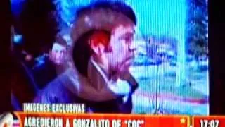 Agresion a Gonzalito www.noticiasdelbolson.com.ar