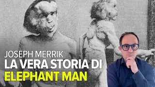 La VERA E CRUDELE storia di ELEPHANT MAN: l'incredibile caso di Joseph Merrik