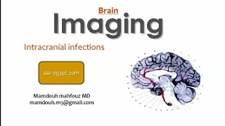 Imaging of intracerebral Infection (DRE) Prof. Mamdouh Mahfouz