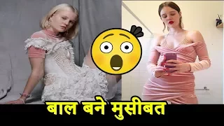 मॉडल के बाल बने मुसीबत, रेप की मिली धमकी|Arvida Bystrom Adidas Shoes add with hairy legs|