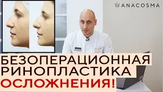 👃 БЕЗОПЕРАЦИОННАЯ РИНОПЛАСТИКА ❗ ОСЛОЖНЕНИЯ и как их избежать