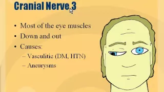 Neuro - Cranial Nerve 3 Palsy