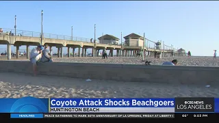 Beachgoers remain wary after toddler attacked by pair of coyotes in Huntington Beach