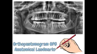 Orthopantomogram OPG Anatomical Landmarks (Complete Lecture) | For NBDE, NDEB, MDS & FCPS