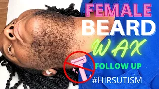 Female With A Beard Gets Waxed #Hirsutism #PCOS