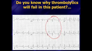 Emerg Med Cardiology Course - feat. Dr. Amal Mattu