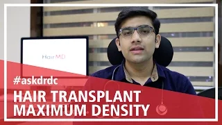 The Maximum Density In Hair Transplant| HairMD, Pune.