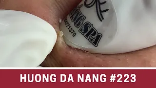 #223 | Huong Da Nang