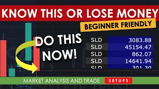 I ALMOST LOST $320,000 IF I DIDN'T KNOW THIS - Day Trading SPY Options