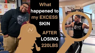 How I Deal With Loose Skin After Losing 220lbs