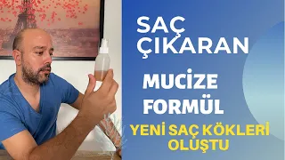 Saç Çıkaran Mucize Doğal Kür I Saçlarım Yeniden Çıktı I Saç Dökülmesine Karşı Çözüm I 4 Ay'da Sonuc