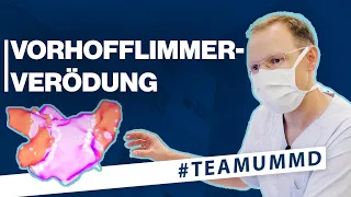 Vorhofflimmern: Die Vorhofflimmer-Verödung