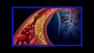 Wie man Triglyceride auf natürliche Weise reduzieren kann